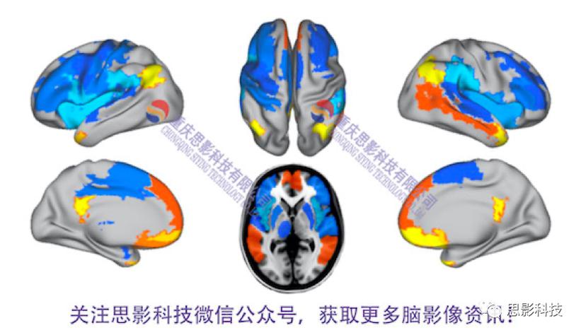 思影科技功能磁共振（fMRI）數據處理業務全解析